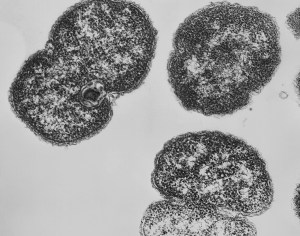 Neisseria-gonorrhoeae-TEM